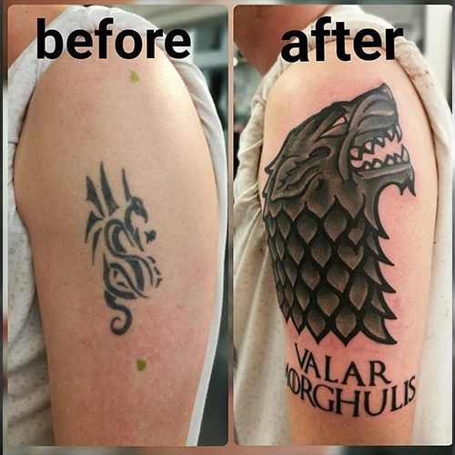 image of laser tattoo removal and coveroup